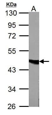 IHC-plus™ FH / Fumarase / MCL Antibody (aa195-473)