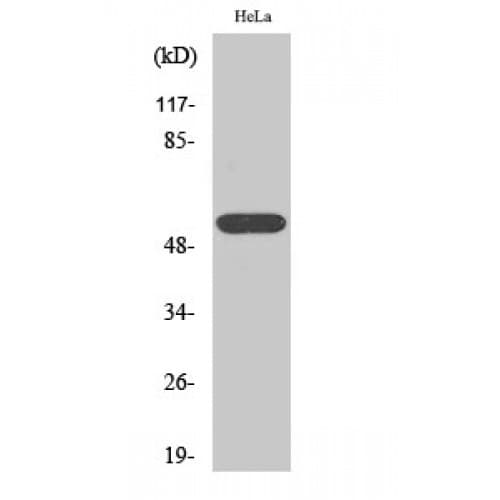 ETV6 / TEL Antibody (340-420 aa, C-terminal)
