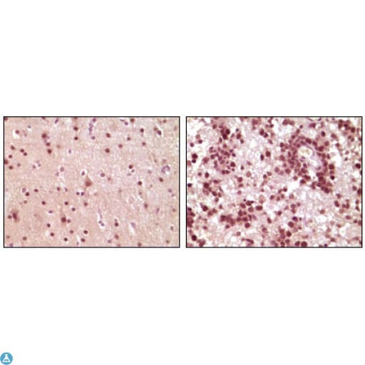 ELK1 Antibody