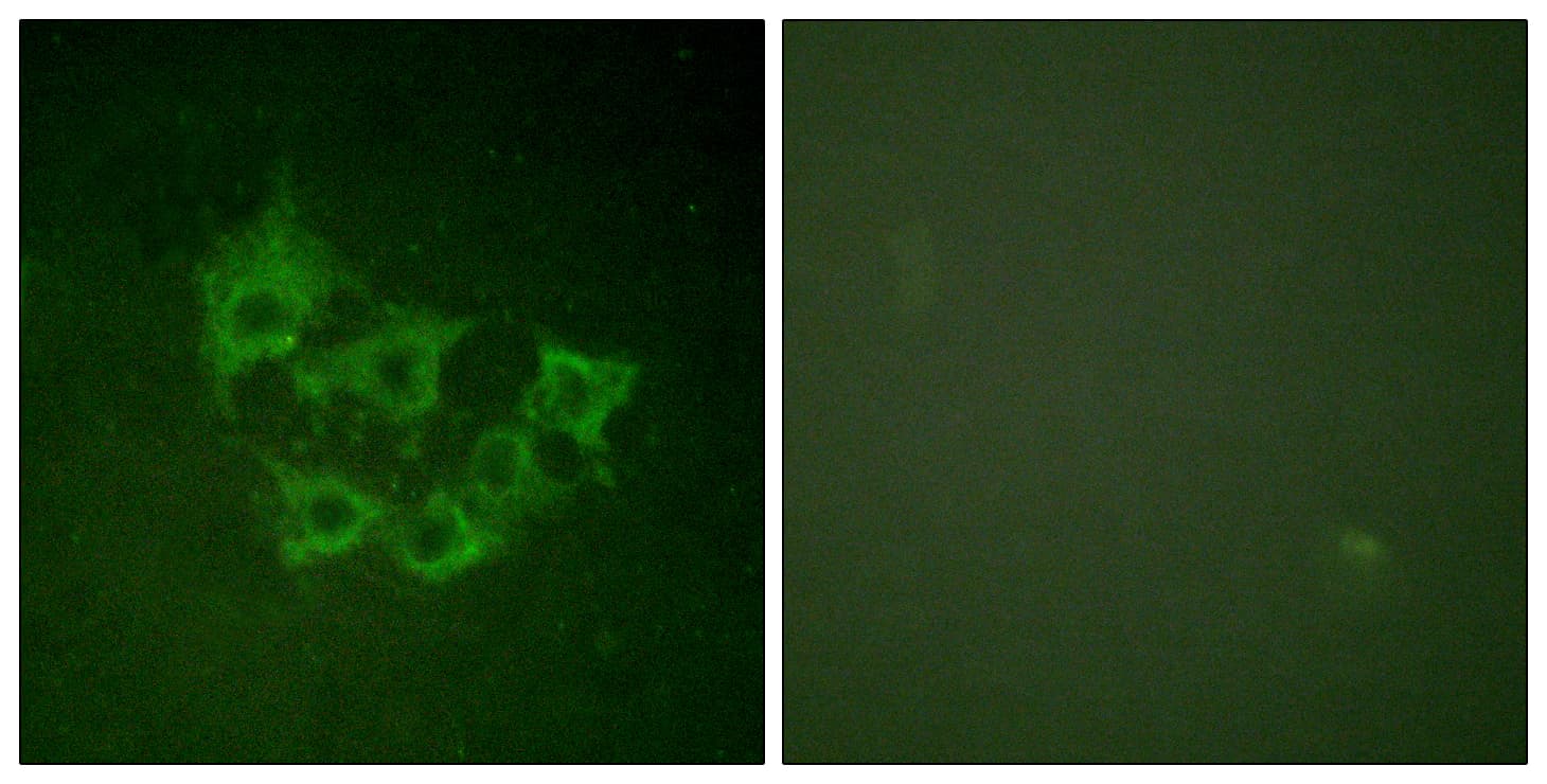 MAP3K8 / TPL2 Antibody (phospho-Thr290)