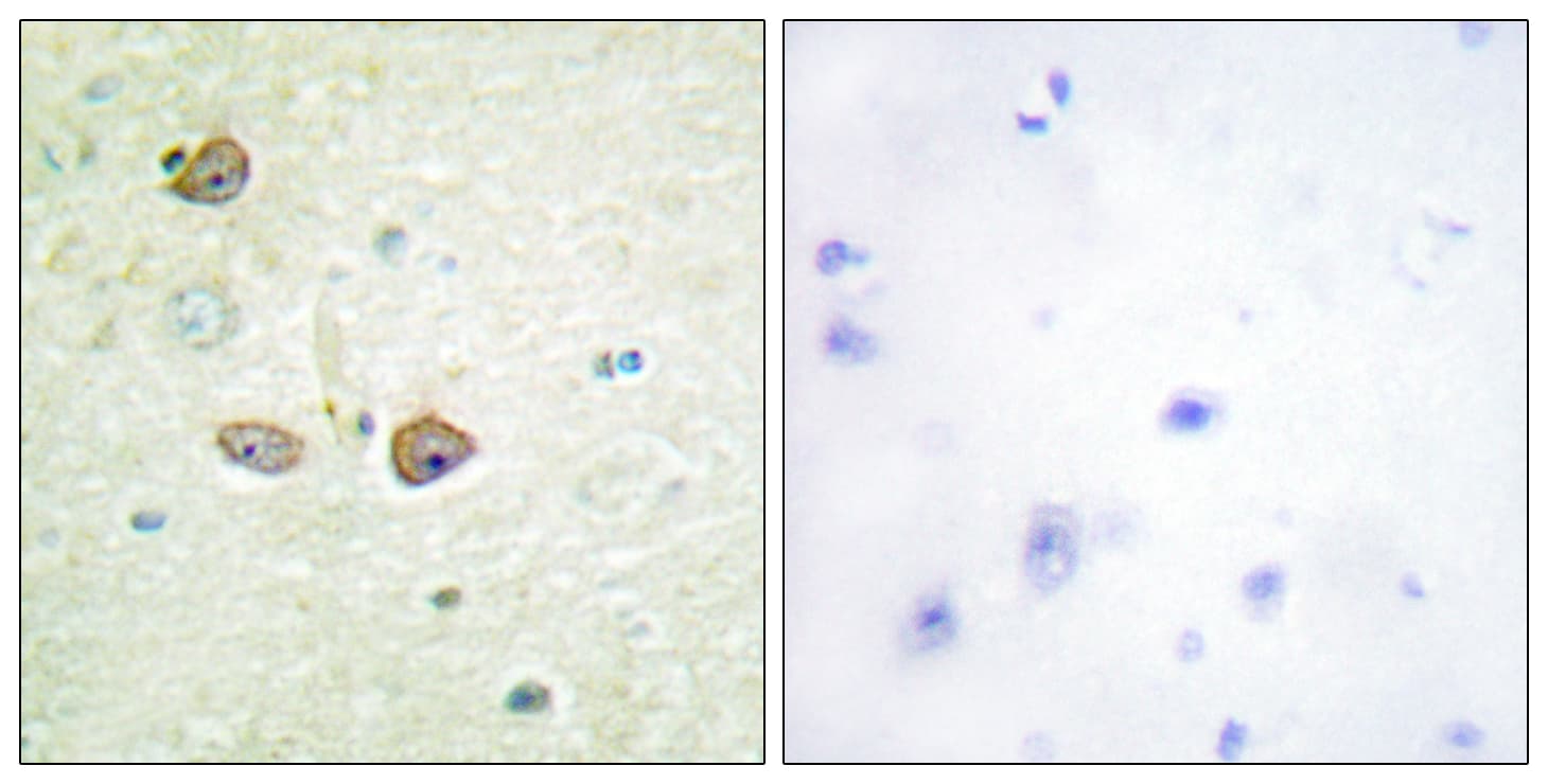 HTR1B / 5-HT1B Receptor Antibody (aa201-250)