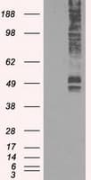 SLC2A5 / GLUT5 Antibody (clone OTI9H4)