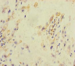 Polyclonal Rabbit anti-Human KLHL26 Antibody (IHC)