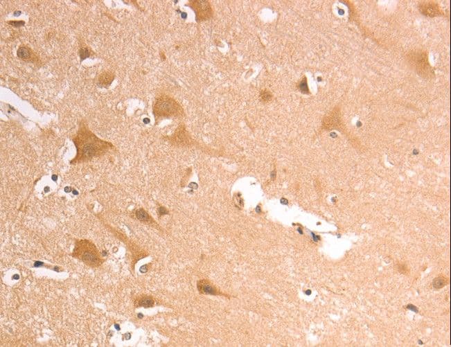 Polyclonal Rabbit anti-Human AASDHPPT / LYS5 Antibody (IHC, WB)