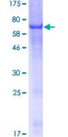 Human P2RX2 / P2X2 Protein (Recombinant GST)
