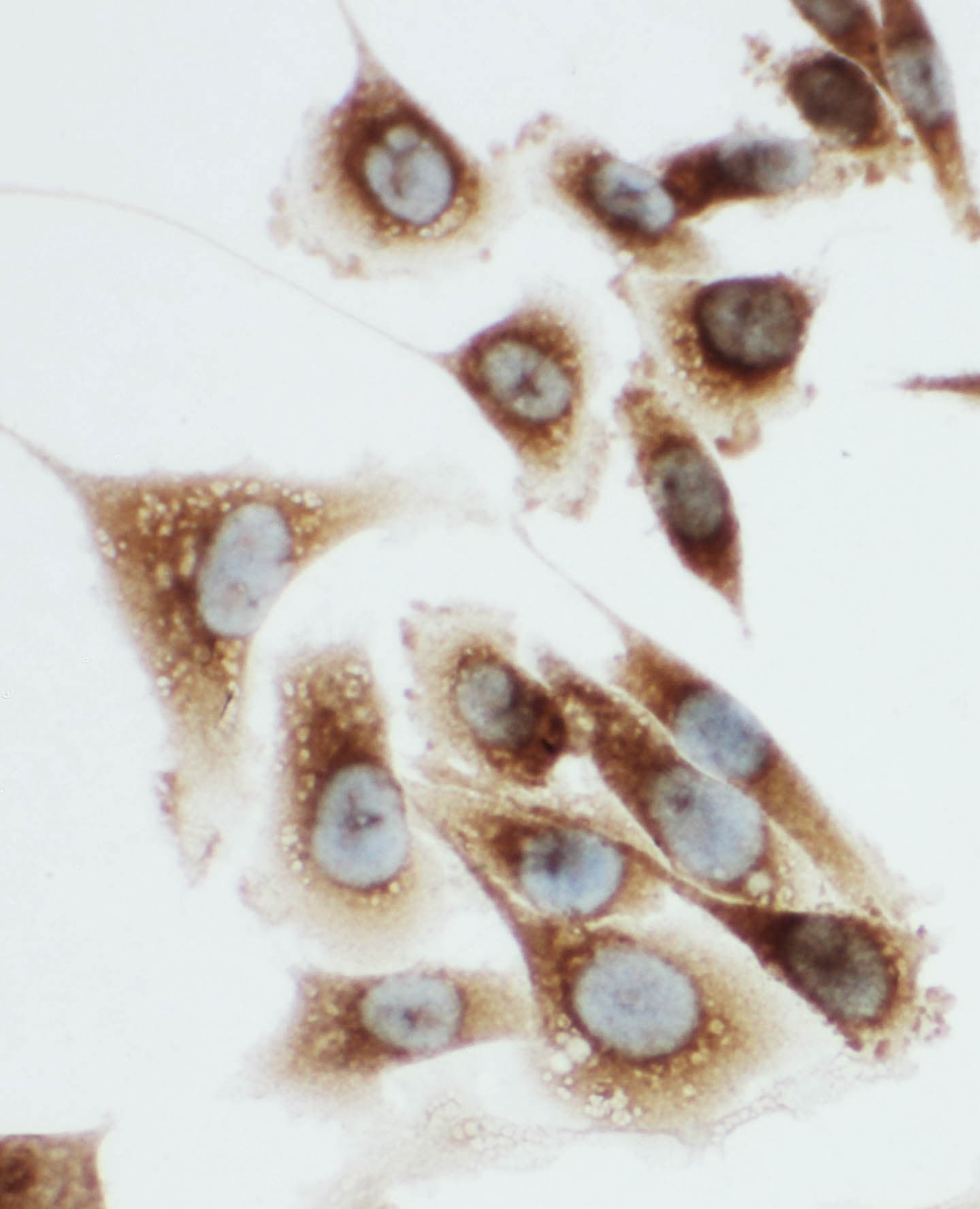 KLK6 / Kallikrein 6 Antibody (aa227-244)
