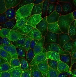 AQP2 / Aquaporin 2 Antibody (aa200-300)