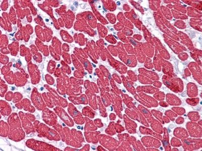 MYL3 Antibody (clone 3F8)
