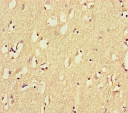 Polyclonal Rabbit anti-Human GPR156 Antibody
