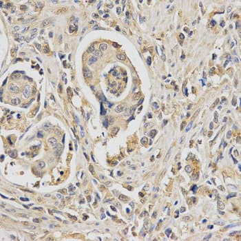 HUS1 Antibody