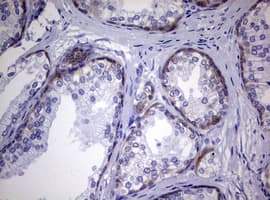 EGFR Antibody (aa900-1210, clone OTI6E3)