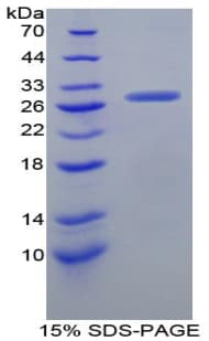 Mouse GRN / Granulin Protein (Recombinant His-T7)