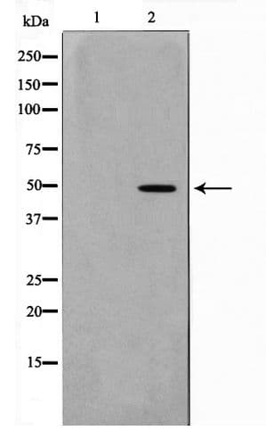 NEUROD2 Antibody