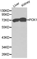 PCK1 Antibody