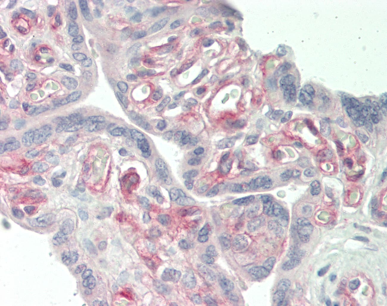 Polyclonal Rabbit anti-Human STOM / Stomatin Antibody (aa203-252, IHC, IF, WB)