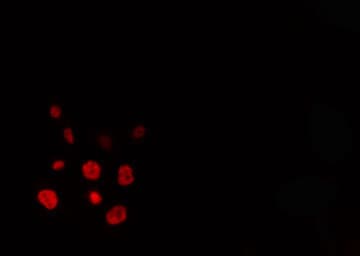ELAVL2 / HUB Antibody