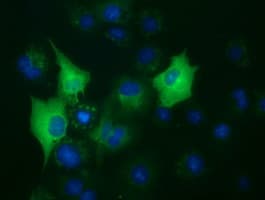 BUB1B / BubR1 Antibody (clone OTI6E3)