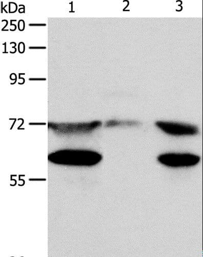Polyclonal Rabbit anti-Human SPDL1 / CCDC99 Antibody (WB)