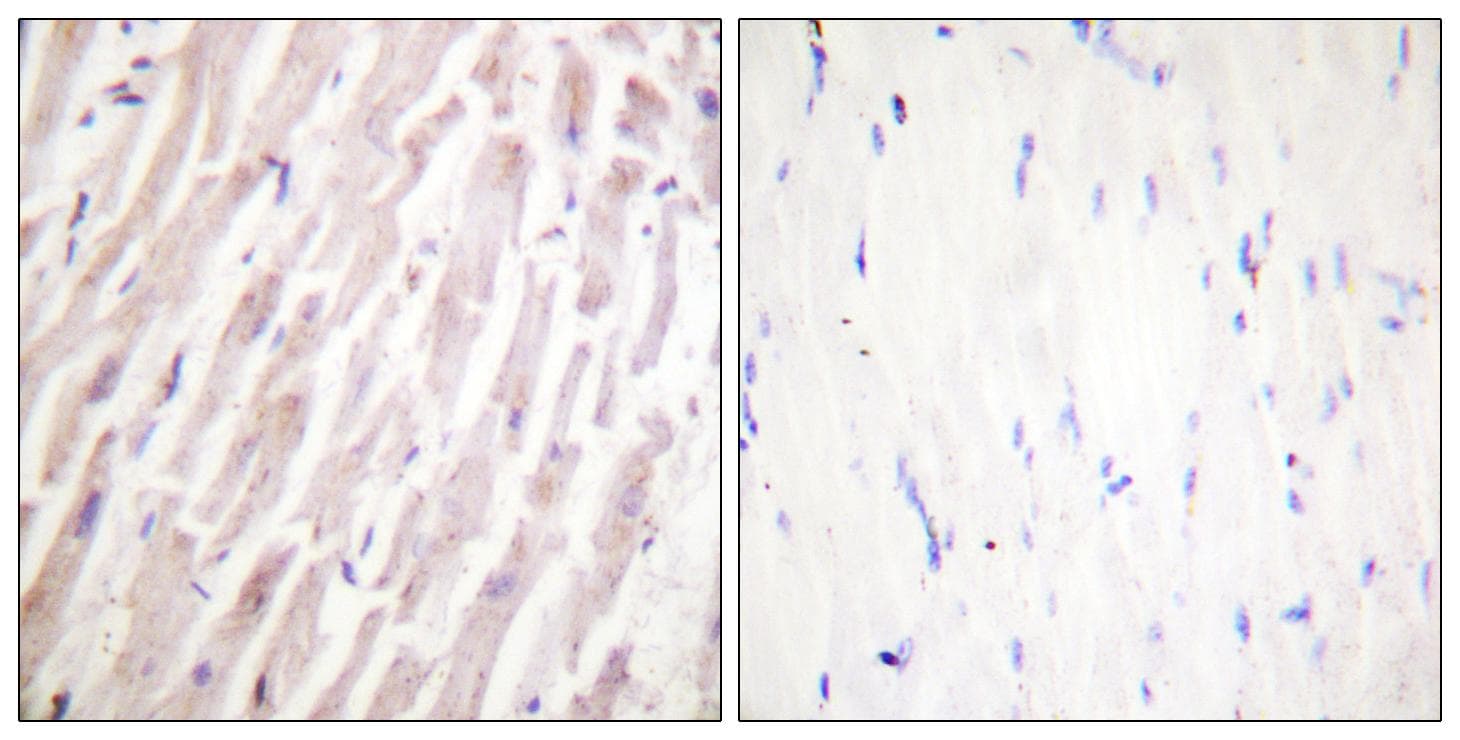 Polyclonal Rabbit anti-Human DMTN / Dematin Antibody (p403, IHC, IF, WB)