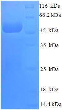 Human COPS7A Protein (Recombinant His-SUMO)