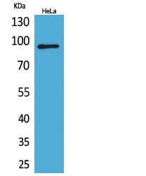 ITGB2 / CD18 Antibody