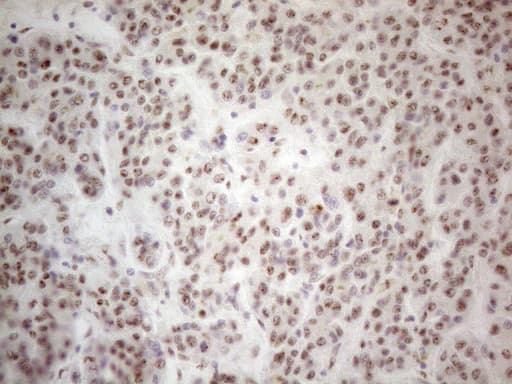 MALT1 Antibody (clone OTI3A2)