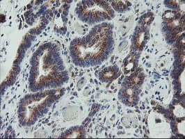 COPD / ARCN1 Antibody (clone OTI6A6)