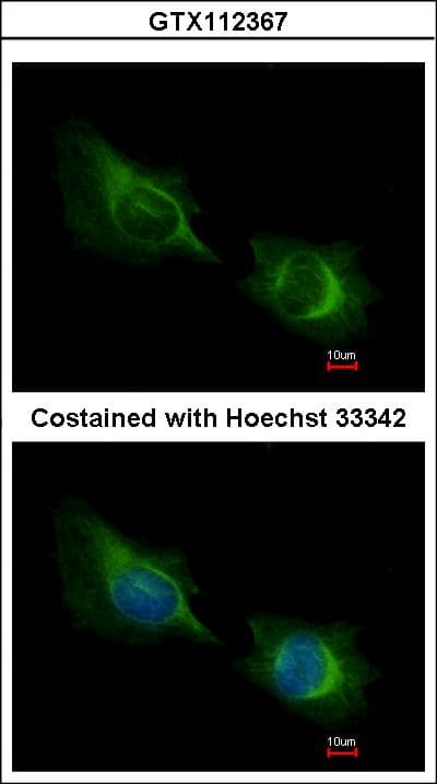 Polyclonal Rabbit anti-Human DTX1 / Deltex Antibody (aa343-617, IHC, WB)