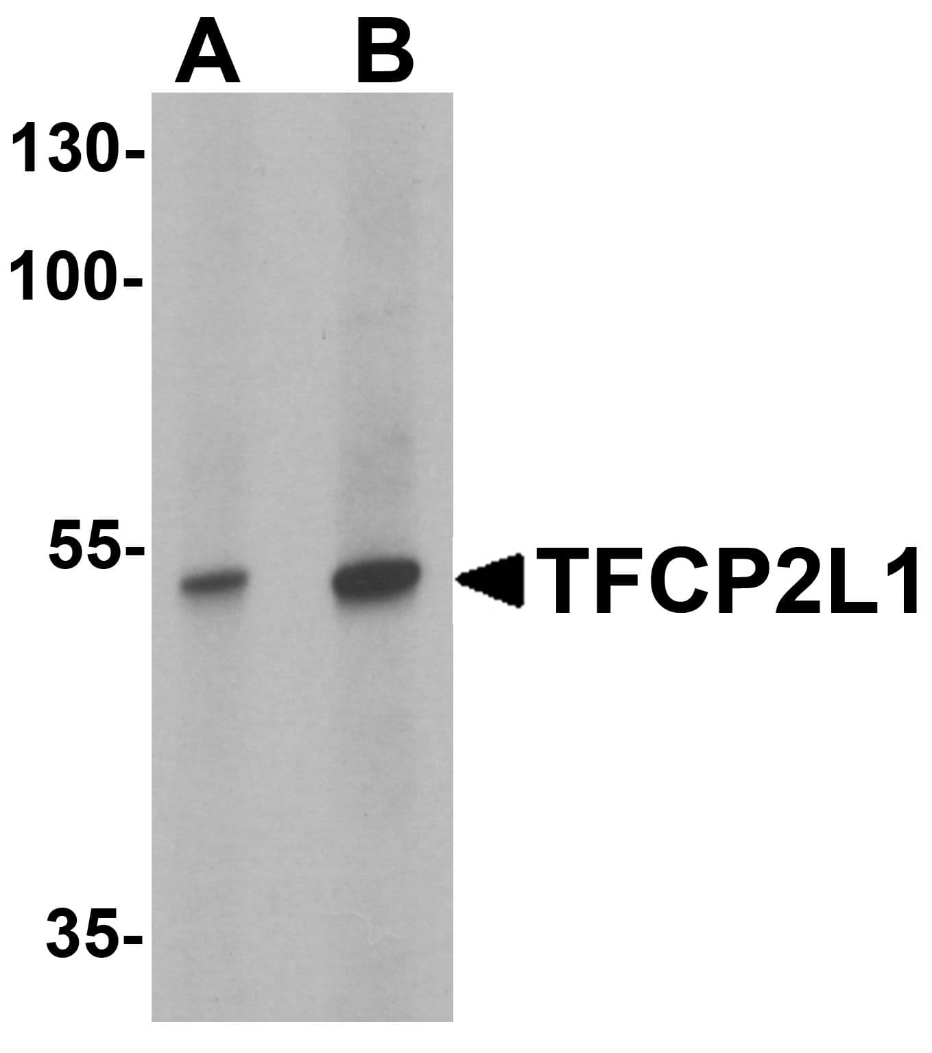 IHC-plus™ CRTR1 / TFCP2L1 Antibody