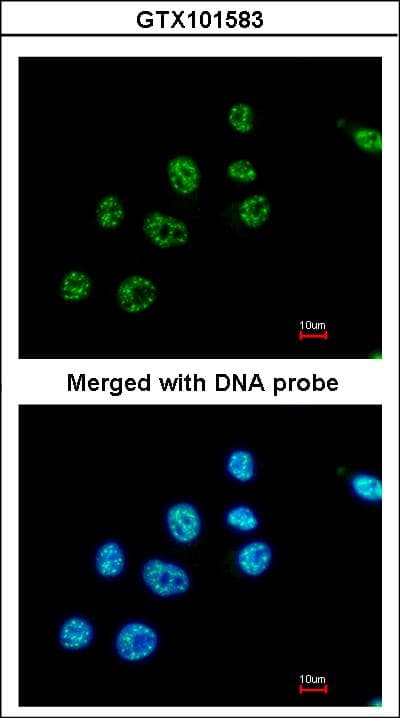 Polyclonal Rabbit anti-Human PAX8 Antibody (aa1-204, IHC, WB)
