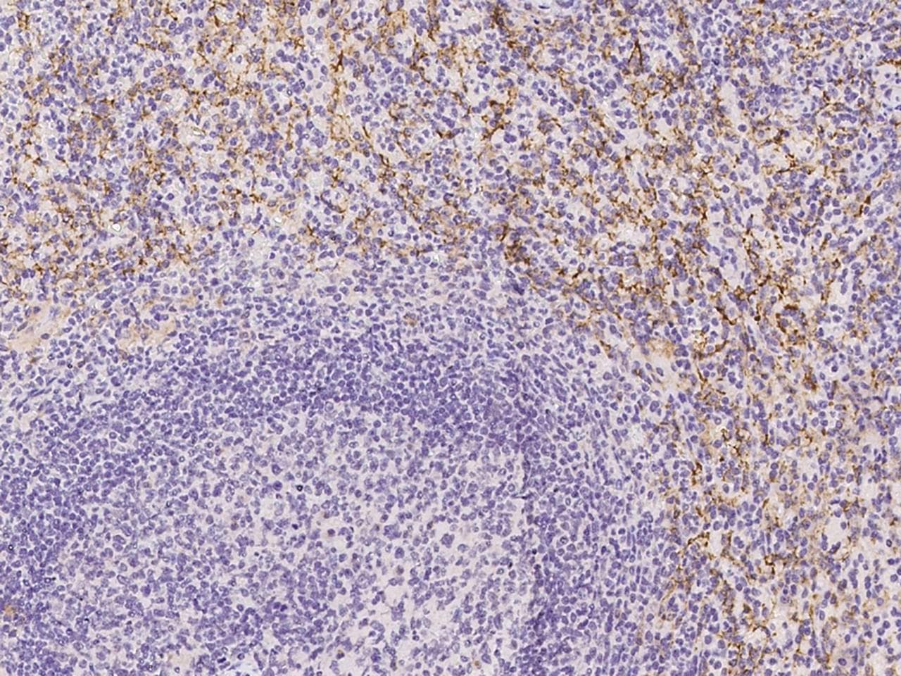 Polyclonal Rabbit anti-Human FCGR3A / CD16A Antibody (Preservative Free, IHC)
