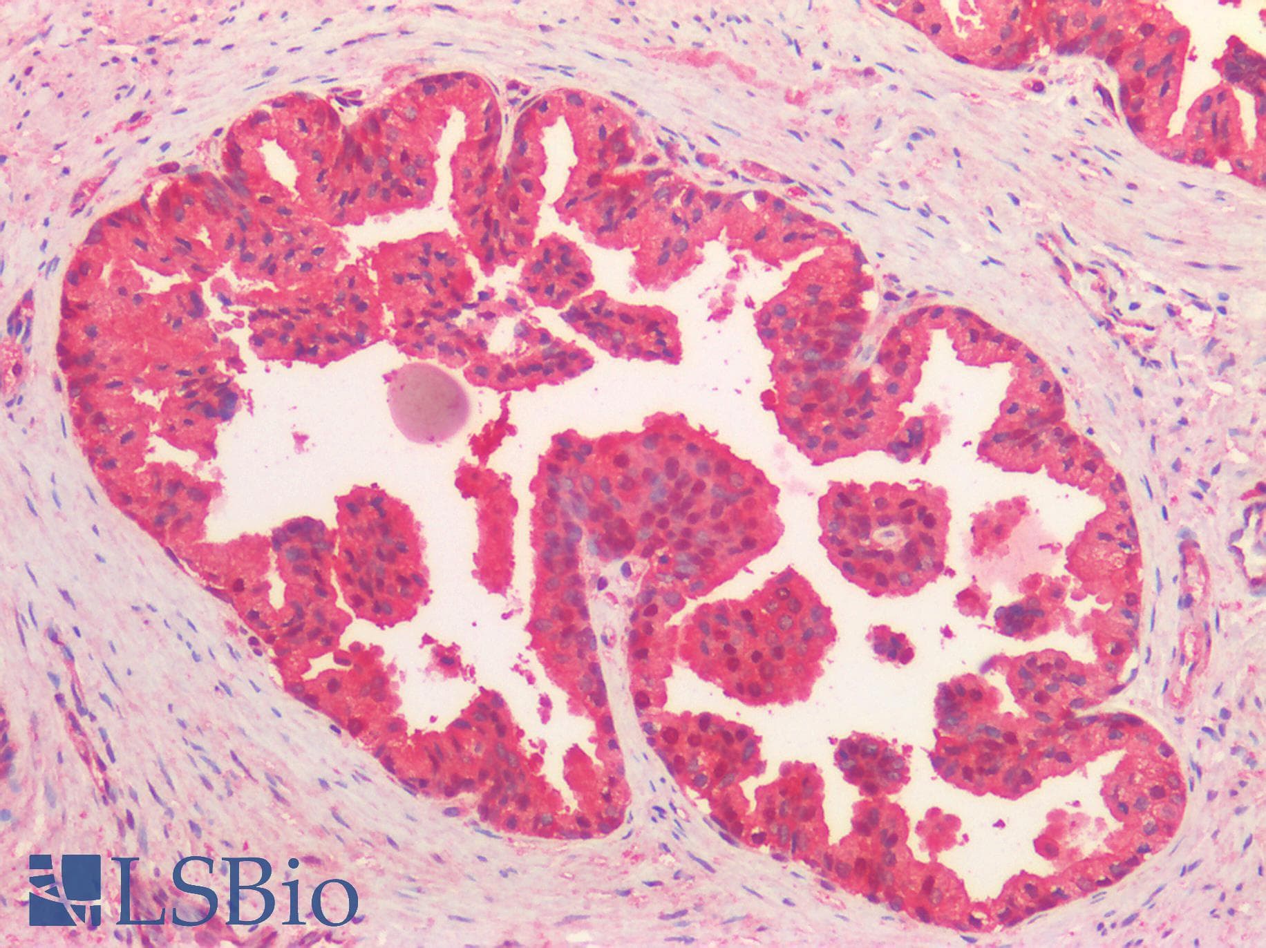 IHC-plus™ VCP Antibody (Internal Region)