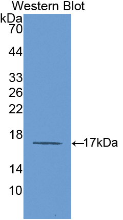 IL6R / IL6 Receptor Antibody (aa214-348)