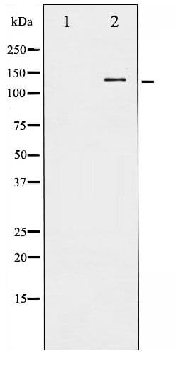 Polyclonal Rabbit anti-Human c-CBL Antibody (phospho-Tyr674, IHC, WB)