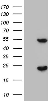 TYW2 / TRMT12 Antibody (clone OTI3D2)
