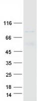 Human NDUFS1 Protein (Recombinant Myc-DDK (Flag))