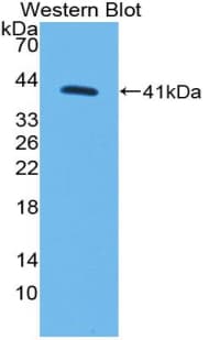 MYO5A / Myosin V Antibody (aa1531-1855)