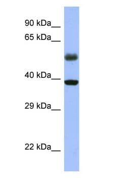 Polyclonal Rabbit anti-Human RBFOX1 / A2BP1 Antibody (N-Terminus, WB)