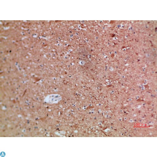 ARTN / Artemin Antibody