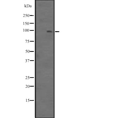 BCL11B Antibody