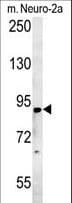 ST18 Antibody (aa339-367)