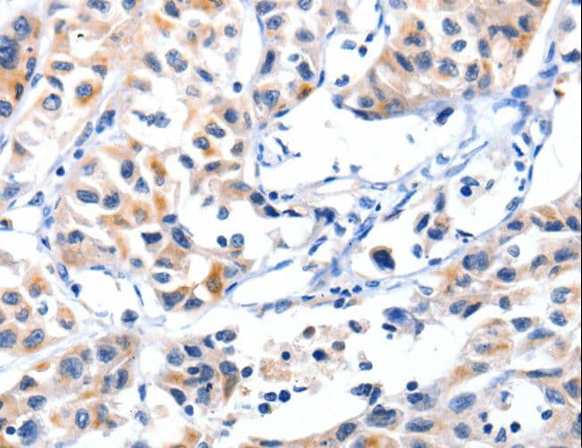 Polyclonal Rabbit anti-Human FBLN5 / Fibulin 5 Antibody (IHC)