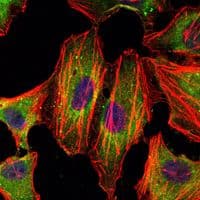 STAT3 Antibody (clone 3B5)