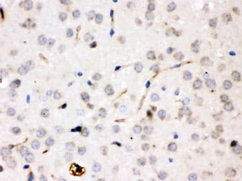 CP / Ceruloplasmin Antibody