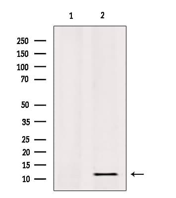Polyclonal Rabbit anti-Human RPL36 / Ribosomal Protein L36 Antibody (IHC, IF, WB)