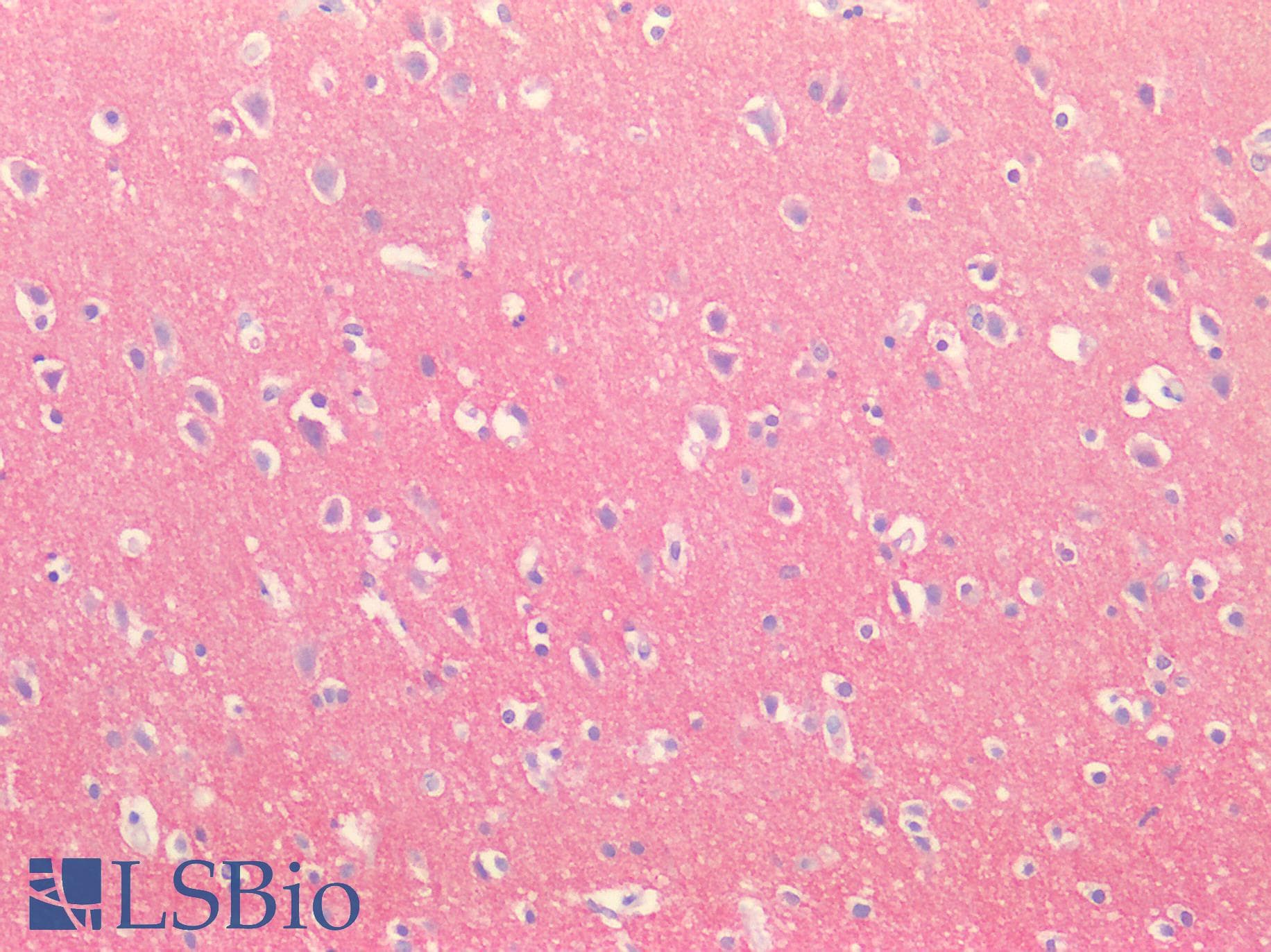 BACE2 Antibody (aa242-502)