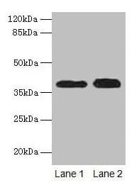 CTSL / Cathepsin L Antibody (aa114-333)