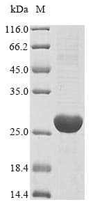 Mouse UPK3A / UPK3 / Uroplakin III Protein (Recombinant 10His, N-terminus + Myc, C-terminus)