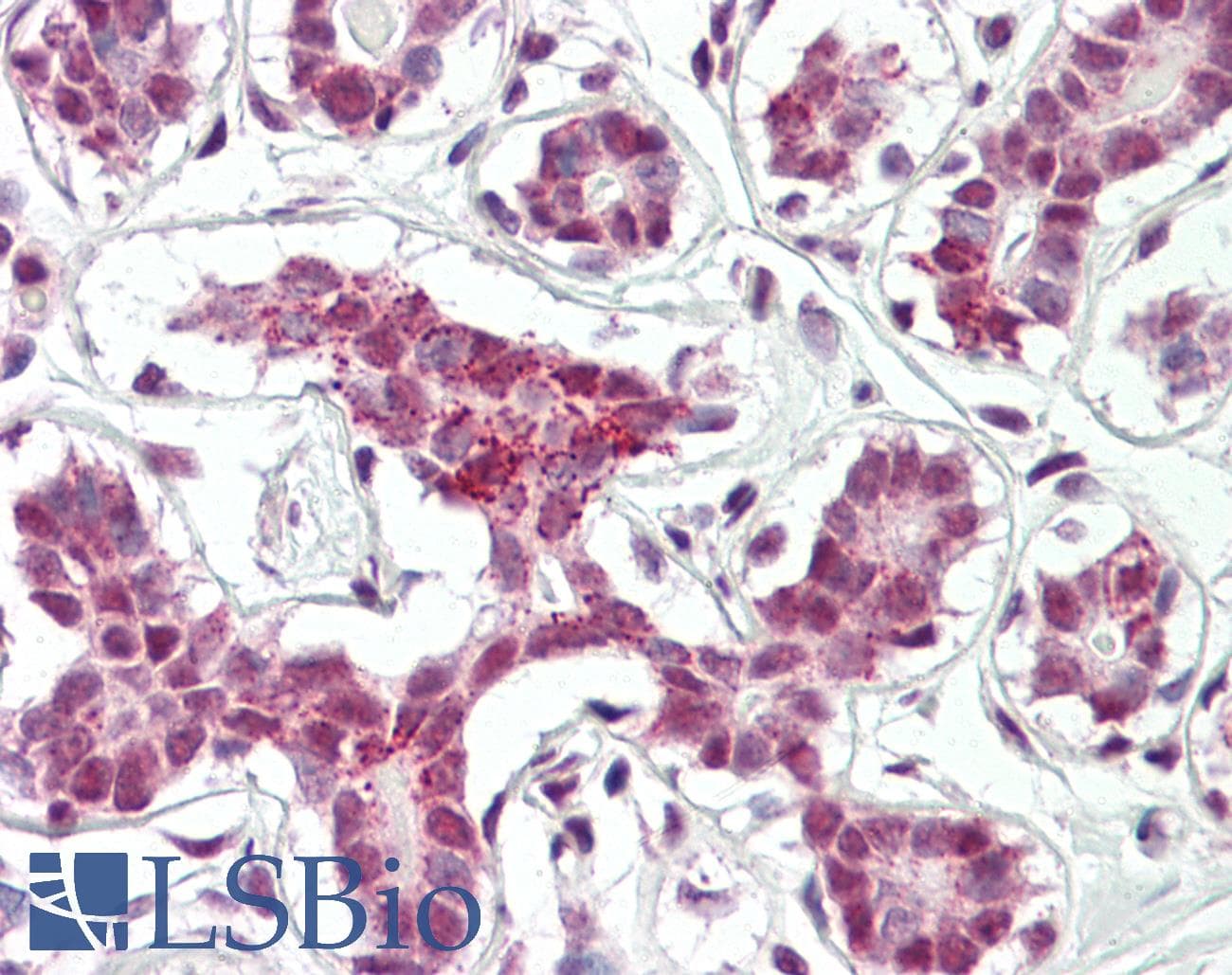 IHC-plus™ TRA2A Antibody (aa221-270)