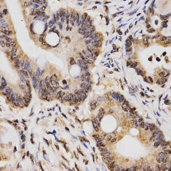 Histone H3 Antibody (Di-Methyl-Lys14)